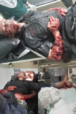 Aksi Begal Sadis Terjadi di Jalan Perkebunan PTPN Betung Krawo Palembang -Jambi km 73