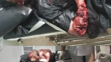 Aksi Begal Sadis Terjadi di Jalan Perkebunan PTPN Betung Krawo Palembang -Jambi km 73